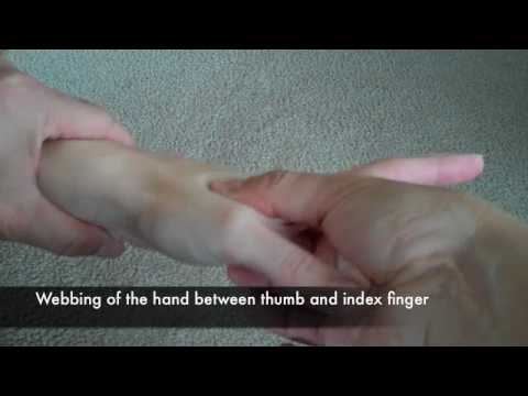 how to relieve head pressure