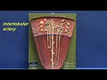 Renal Lobe Model - Cortex & Medulla.avi