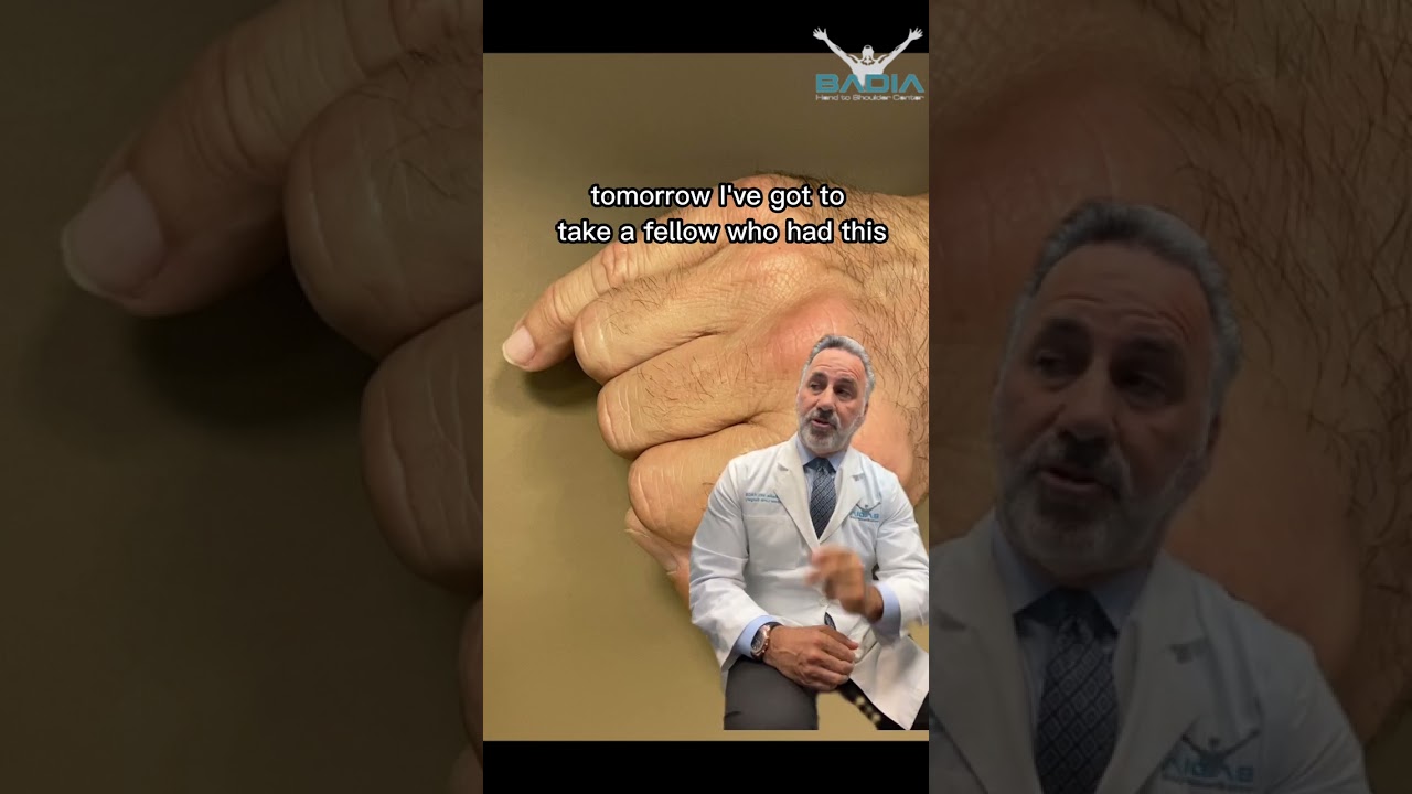 Dr.Badia explains finger fractures & why they should be taken seriously!