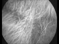 Hiding magnets in blood brings scans into focus