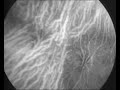Hiding magnets in blood brings scans into focus