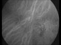 Hiding magnets in blood brings scans into focus