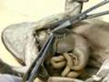 Heart dissection from Digital Frog virtual frog dissection