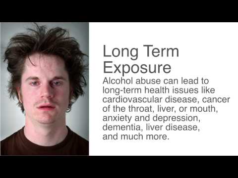 10 common alcohol abuse facts