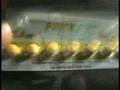 The Drugging of Our Children - Trailer