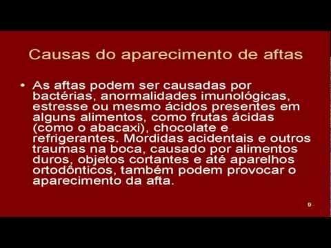 how to cure aftas