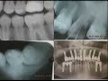 PSICODENT CLINICA MOVIL