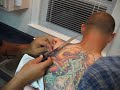 my buddies convinced me to cut off my skin tag while i was drunk.
