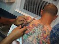 my buddies convinced me to cut off my skin tag while i was drunk.
