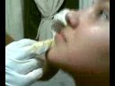 �Perforaci�n de la Magda?