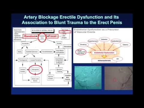 how to unclog penile arteries