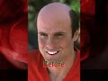 No Acne Huckabee Ad