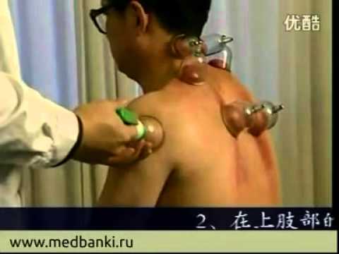 б дюсупов сеанс исцеления смотреть бесплатно