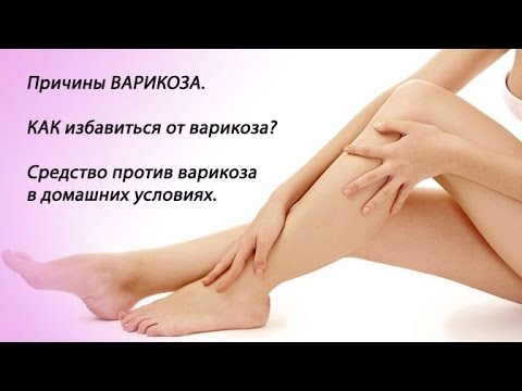 Как избавится от варикозы в домашних условиях