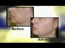 Stockton-CA-Dermatol