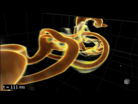 Vortex ring collisions
