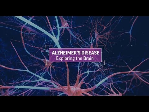Alzheimer's Disease: Exploring The Brain - YouTube