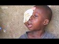Medical volunteers try to help a young boy who has eye cancer in Sierra Leone, Africa - BBC
