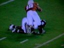 UT broken leg UT broken leg