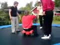 broken leg on the trampoline!