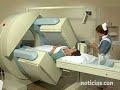 Detectar la afectación del ganglio centinela permite mejorar el diagnóstico y el tratamiento en tumores de vulva y cérvix Vulvar Cancer