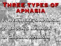 aphasia is a possible result of a stroke.  here, we discuss the three forms this condition can take.