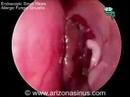 otolaryngology