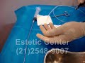 LipoLaser - Lipo laser - Material usado- Estetic Center