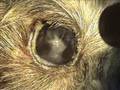Queratoconjuntivitis seca Queratoconjuntivitis seca