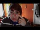 The Botox: Ep. 2