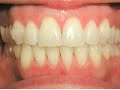 Dr. Nikaeen - Los Angeles Invisalign Orthodontist