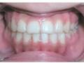 Dr. Nikaeen - Los Angeles Invisalign Orthodontist