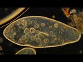 Amazing Microscopic HD Video! Paramecium Feeding!! - YouTube