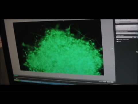 how to eliminate biofilm