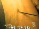 New Image Cosmetic Surgery Los Angeles San Diego Orange County New Image Cosmetic Surgery Los Angeles San Diego Orange County
