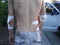 Longboard Crash on Bubb Hill Longboard Crash on Bubb Hill
