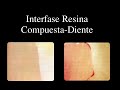 Adhesivos-dentinales