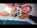 Down syndrome:&nbsp;Down Syndrome baby getting an EKG