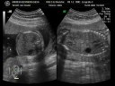 Ultrasound/Ecografia 3D/4D - Guilherme