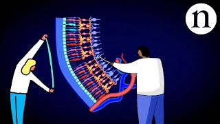 Retinal repair: Bringing stem cells into focus