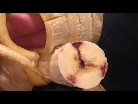 Blutbanane - Unbekannte schren Angst vor 