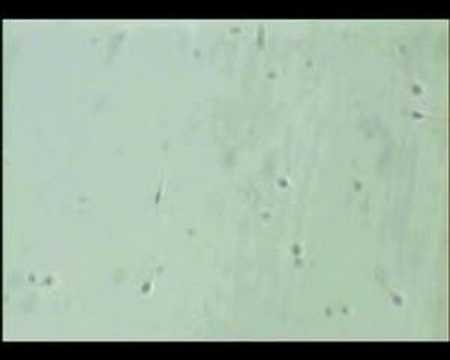 Day 0 (Sperm Prep.,)