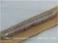 DALLAS HAIR TRANSPLANT: REGIONAL OCCIPITAL HAIR DIFFERENCES DALLAS HAIR TRANSPLANT: REGIONAL OCCIPITAL HAIR DIFFERENCES