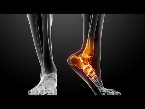 how to eliminate foot pain