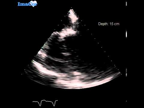 how to assess volume status