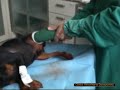 Applicazione del bendaggio compressivo di Robert Jones Applicazione del bendaggio compressivo di Robert Jones