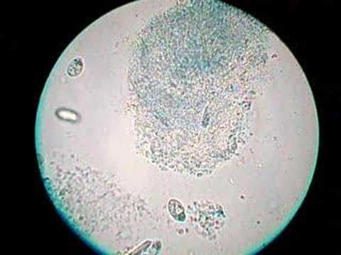Paramecium 1