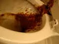 My shitty day