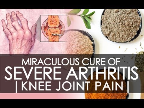 how to cure arthritis pain