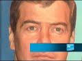 The Dmitry Medvedev hype